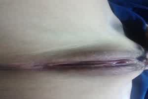 16岁初中生自慰  背景图片